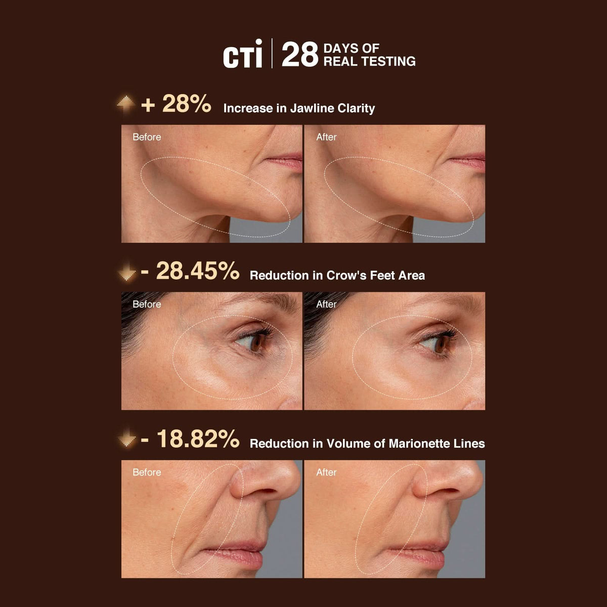 AMIRO U1 UltraLift Skin Tightening Ultrasound Facial Device