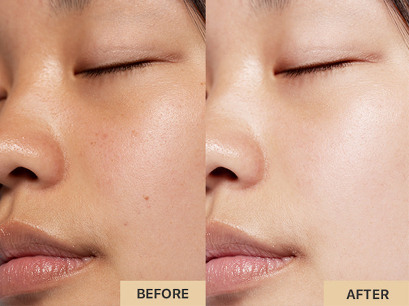 Red Light Therapy Mask Skin Brightening Before and After