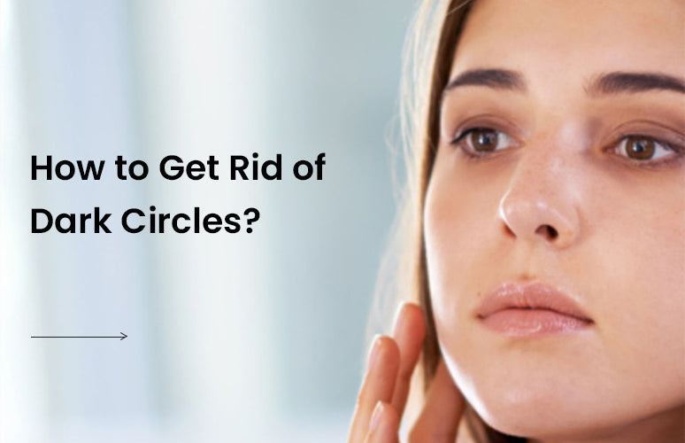 How to Get Rid of Dark Circles?