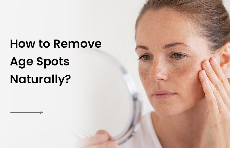 How to Remove Age Spots Naturally?