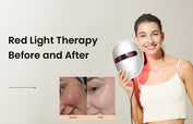 Red Light Therapy Before and After