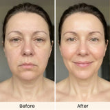 AMIRO 4-in-1 CryoLift Facial Device