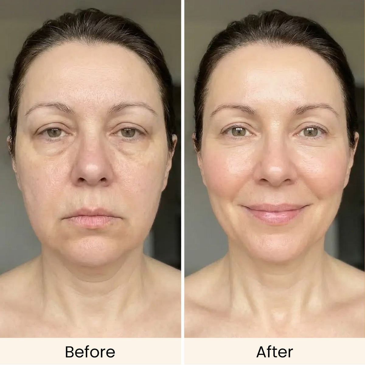 AMIRO 4-in-1 CryoLift Facial Device