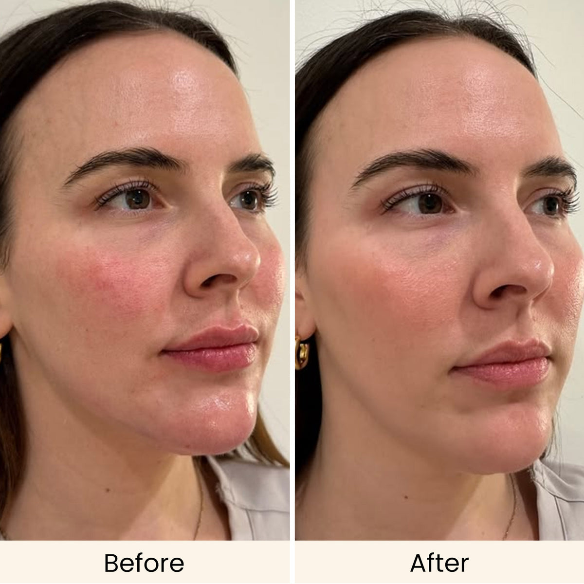 AMIRO 4-in-1 CryoLift Facial Device