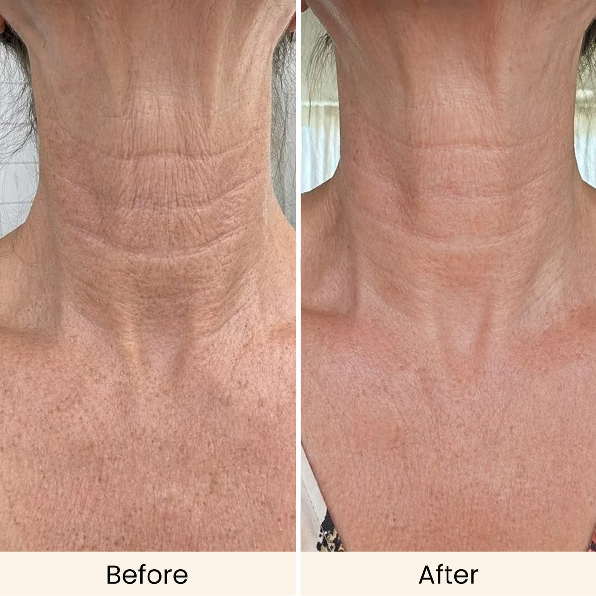 AMIRO 4-in-1 CryoLift Facial Device