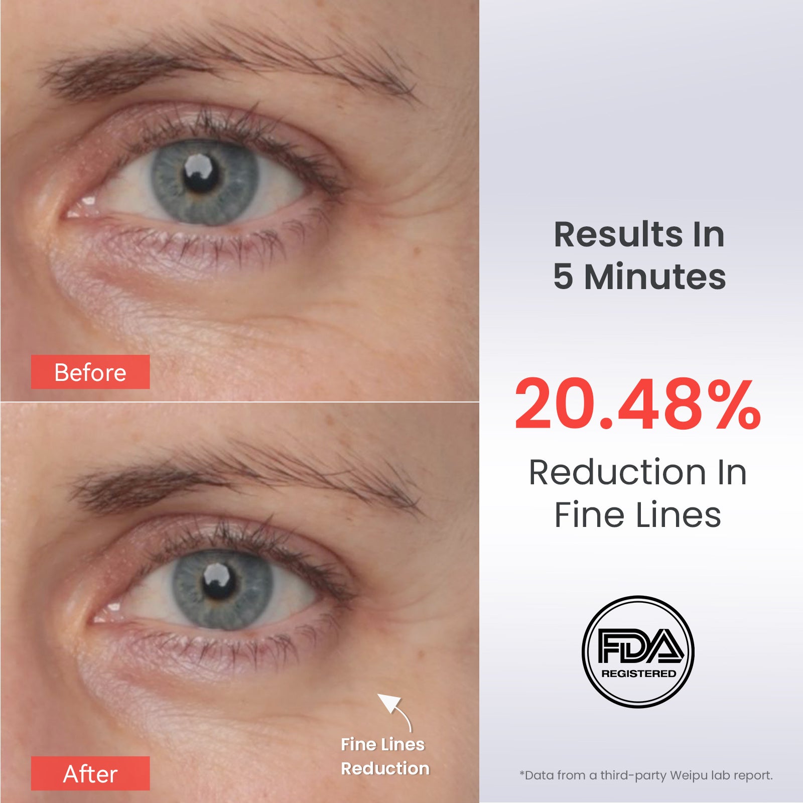 AMIRO EyeGlow Red Light & Microcurrent Eye Cream