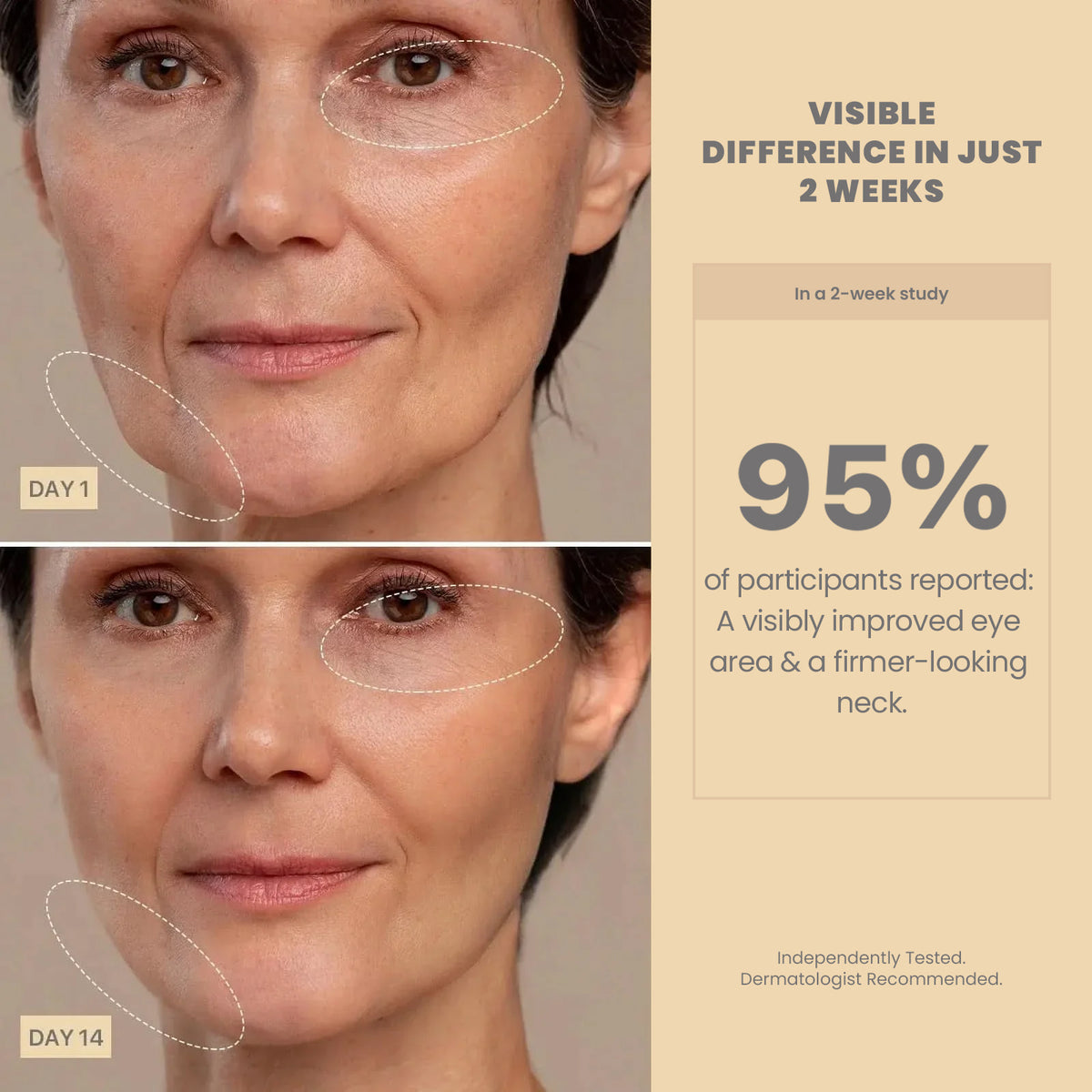 AMIRO R3 Turbo Facial RF Beauty Tool