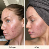 AMIRO Spectra 10-in-1 LED Light Therapy Mask