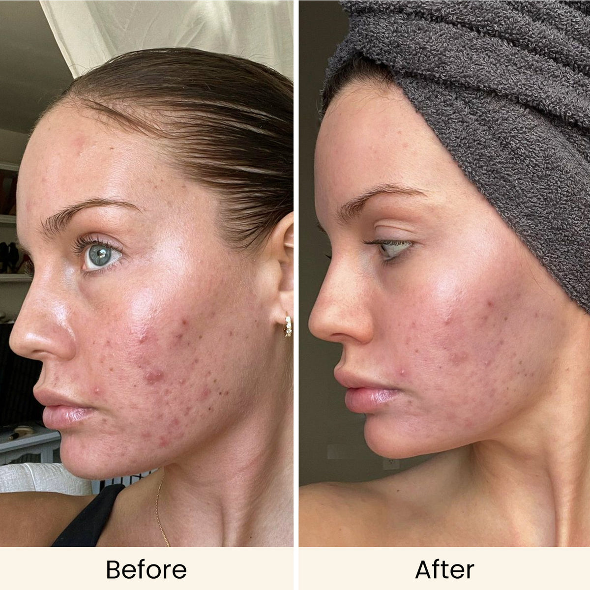 AMIRO Spectra 10-in-1 LED Light Therapy Mask